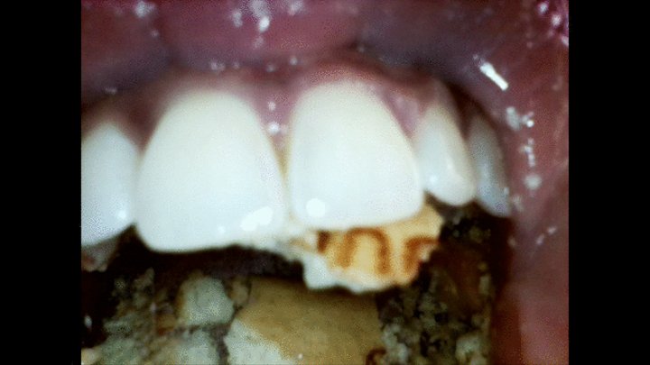 Endoscope camera views of my dirty mouth